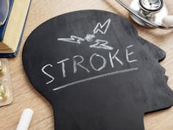 Myth Buster: Common Misconceptions About Stroke