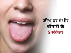 जीभ पर होने वाली ये 5 परेशानियां हैं शरीर में इस विटामिन की कमी! जानें कभी न ठीक होने वाली कौन सी है ये बीमारी