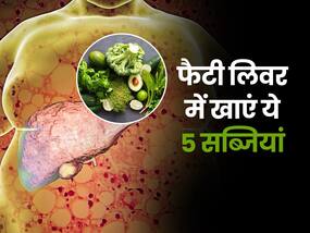 बिना शराब पिएं लिवर पर आई सूजन? इन 5 फूड्स का सेवन लिवर की सूजन को करेगा कम, जानें बेस्ट फूड्स की लिस्ट