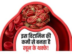 नसों में थक्कों को बनने से रोकते हैं ये 5 फूड्स! जानें किस विटामिन की कमी से नसों में बनते हैं खून के थक्के