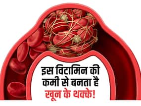 नसों में थक्कों को बनने से रोकते हैं ये 5 फूड्स! जानें किस विटामिन की कमी से नसों में बनते हैं खून के थक्के