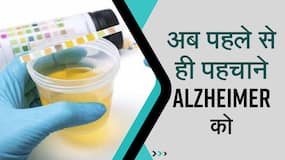 Alzheimer: यूरिन टेस्ट से अब अल्ज़ाइमर का पता लगपाएगा, शोध से पता लगा, Watch video