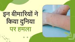 Diseases: मंकीपॉक्स और निपाह वायरस जैसी इन बीमारियों ने किया दुनिया पर हमला, Watch Video