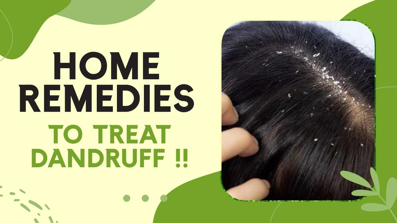 Dandruff Home Remedies: Know How To Cure Dandruff Problem In Winters, Watch  Video 