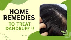 Dandruff Home Remedies: Know How To Cure Dandruff Problem In Winters, Watch Video