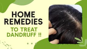 Dandruff Home Remedies: Know How To Cure Dandruff Problem In Winters, Watch Video