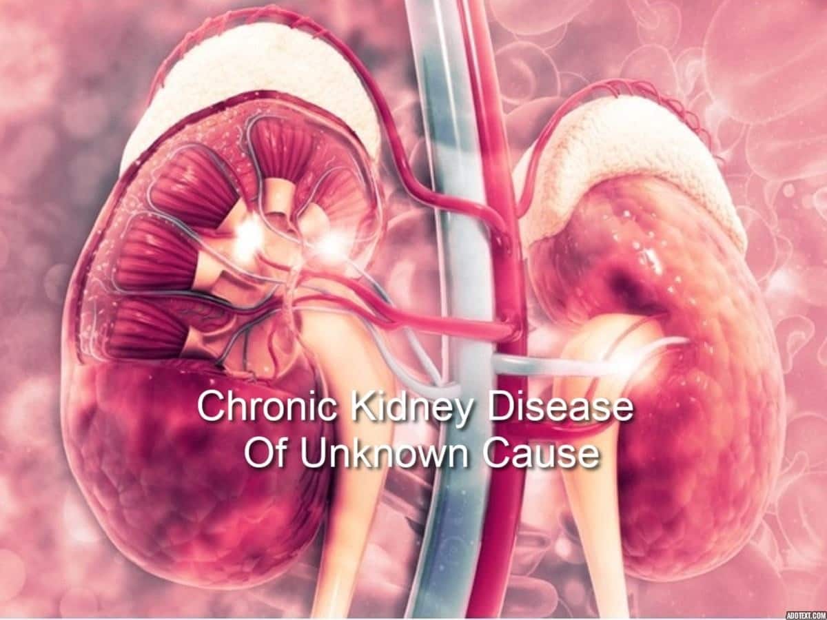 Chronic Kidney Disease Of Unknown Causes In India: Know the details