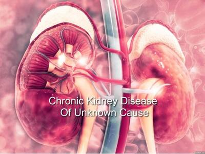 Chronic Kidney Disease Of Unknown Causes In India: Treatment ...