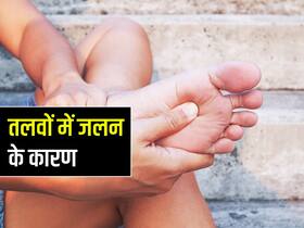 पैरों की जलन को ना समझें मामूली, शरीर में छुपी इन 4 बीमारियों का हो सकती है लक्षण