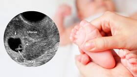What Causes Conception To Fail? Doctor Shares Top 10 Causes of Failed Pregnancy