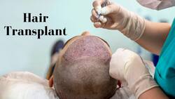 Hair Transplant: Precautions To Consider Before And After Undergoing Hair Transplant Surgery
