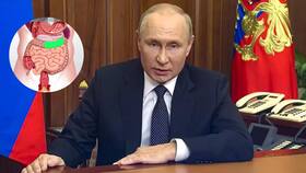 Involuntary Defecation: Vladimir Putin Slipped On Stairs Causing Him To Involuntarily Defecate, What Is This Condition?