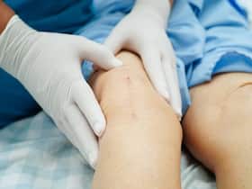Arthroplasty 101: An insight Into Joint Replacement Surgery