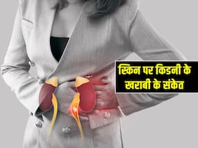 त्वचा पर दिखें ये 5 संकेत तो समझ लें खराब हो रही है आपकी किडनी, तुरंत कराएं ये एक टेस्ट