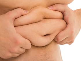 Obesity Growing Rapidly in India, 3-Fold Increase In Bariatric Surgery In Last 5 Years: Warn Doctors Obesity Growing Rapidly in India, 3-Fold Increase In Bariatric Surgery In Last 5 Years: Warn Doctors