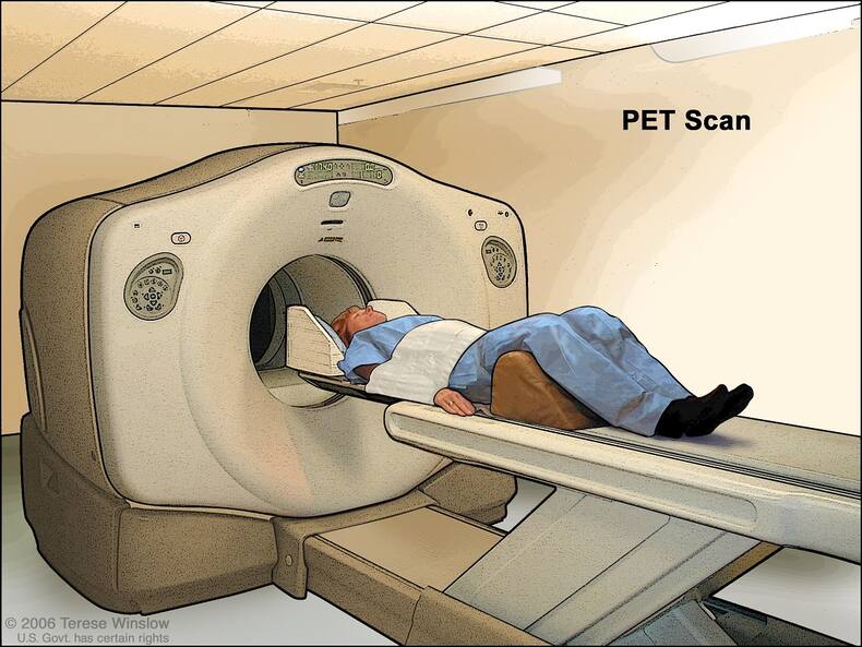 CT, MRI, And PET: What We Must Know About These Scans