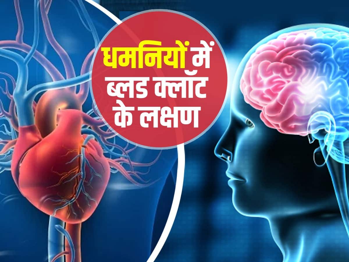 Blood Clot Symptoms In Heart And Brain In Hindi हृदय और मस्तिष्क की धमनियों में ब्लड क्लॉट के