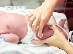 Liver Transplant Successfully Conducted On 23-Day-Old Baby Diagnosed With Galactosemia