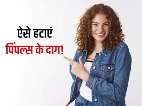 पिंपल्स के दाग से चेहरा दिखने लगता है भद्दा, इन 5 तरीकों से स्किन को करें बेदाग पिंपल्स के दाग से चेहरा दिखने लगता है भद्दा, इन 5 तरीकों से स्किन को करें बेदाग