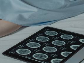 Alzheimer s Breakthrough: Drug Lecanemab Found To Delay Brain Cell Destruction Alzheimer s Breakthrough: Drug Lecanemab Found To Delay Brain Cell Destruction