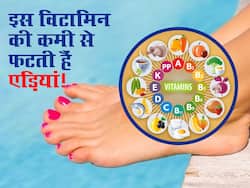 इस जरूरी विटामिन की कमी का संकेत हो सकता है एड़ियां फटना, बीमार पड़ने से पहले ही डाइट में शामिल करें ये 5 फूड्स