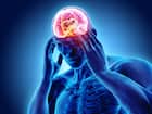 मस्तिष्क में सूजन (Encephalitis)