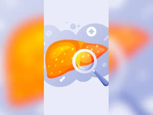 7 Physical Signs Of Sluggish Liver