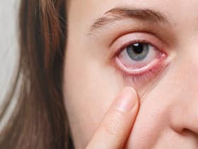 How Not To Let Your Eyes Run Dry? Explains Dr Saurabh Choudhry
