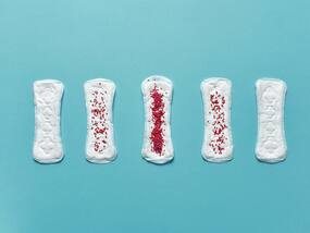 Was It Your Periods Or Spotting? Know The Difference