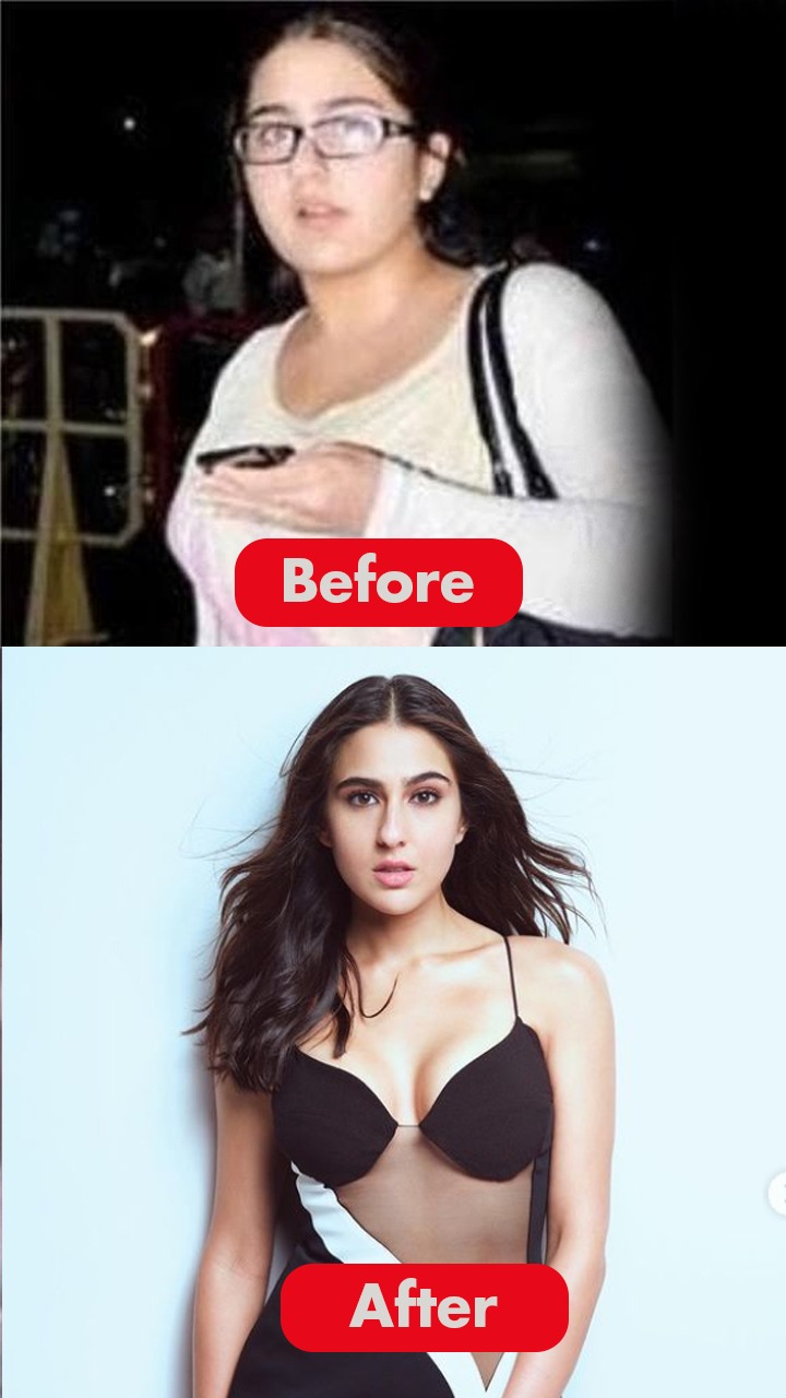 PCOS рд╣реЛрдиреЗ рдмрд╛рд╡рдЬреВрдж рд╕рд╛рд░рд╛ рдЕрд▓реА рдиреЗ рдХреИрд╕реЗ рдХрдо рдХрд┐рдпрд╛ 96kg рд╡рдЬрди?