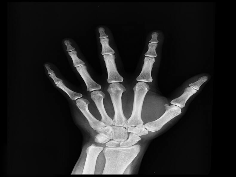 CT, MRI, And PET: What We Must Know About These Scans