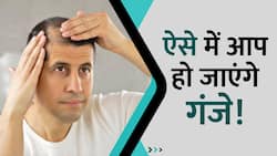 स्टडी में खुलासा, ये पिया तो जल्द हो सकते हैं गंजे! Watch Video