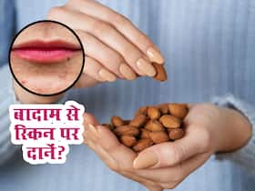 बादाम में मौजूद इस चीज की वजह से स्किन पर बढ़ने लगते हैं दानें! जानें बादाम का कौन सा गुण स्किन के लिए है हानिकारक