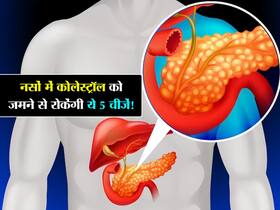 नसों में बैड कोलेस्ट्रॉल को जमने से रोकती हैं ये 5 चीजें! खाते ही शरीर पर दिखने लगता है असर