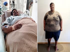 Morbid Obesity: When Bariatric Surgery May Be The Only Option For A Patient? Morbid Obesity: When Bariatric Surgery May Be The Only Option For A Patient?