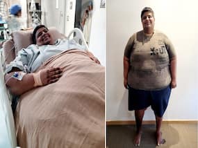 Morbid Obesity: When Bariatric Surgery May Be The Only Option For A Patient?