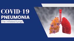 COVID-19 Pneumonia: Chronic Muscle Pain And Other Unusual Symptoms To Watch Out For