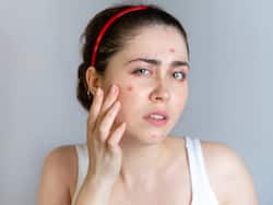 Face Yoga Could Help Treat Acne: International Face Yoga Expert Mansi Gulati Explains How