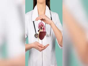 Causes of kidney stones