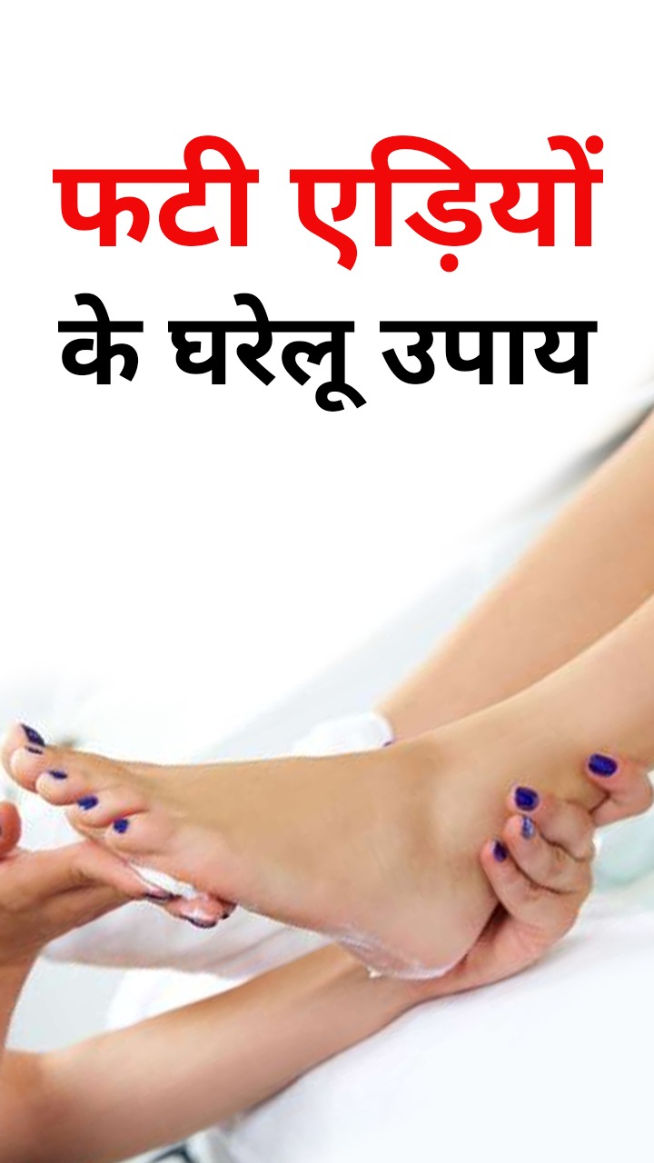 सर्दियों में फटी एड़ियों से आराम दिलाएंगे ये 6 घरेलू उपाय