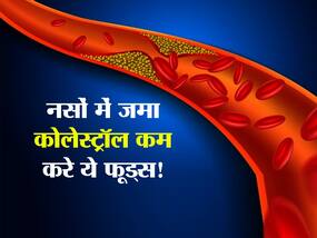 बढ़ा हुआ कोलेस्ट्रॉल होगा तेजी से कम, डाइट में शामिल करें बस ये 5 सुपरफूड्स बढ़ा हुआ कोलेस्ट्रॉल होगा तेजी से कम, डाइट में शामिल करें बस ये 5 सुपरफूड्स