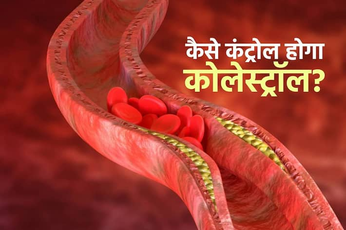 s-cholesterol-meaning-in-hindi-s-cholesterol-ka-kya-matlab-hota-hai