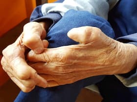 Facts About Leprosy We Should Be Aware Of Facts About Leprosy We Should Be Aware Of