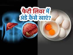 फैटी लिवर में अंडा खाना चाहिए या नहीं, Fatty Liver में अंडे कैसे खाएं?