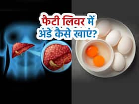 फैटी लिवर में अंडा खाना चाहिए या नहीं, Fatty Liver में अंडे कैसे खाएं? फैटी लिवर में अंडा खाना चाहिए या नहीं, Fatty Liver में अंडे कैसे खाएं?