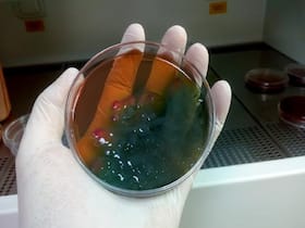 Fecal Transplant Saves 2-Year-Old Child Suffering From Uncontrolled Diarrhea