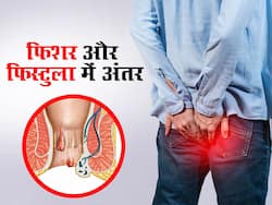 पाइल्स से भी ज्यादा दर्दनाक है फिशर और फिस्टुला (भगंदर); जानिए इनके लक्षण, कारण, उपचार और अंतर
