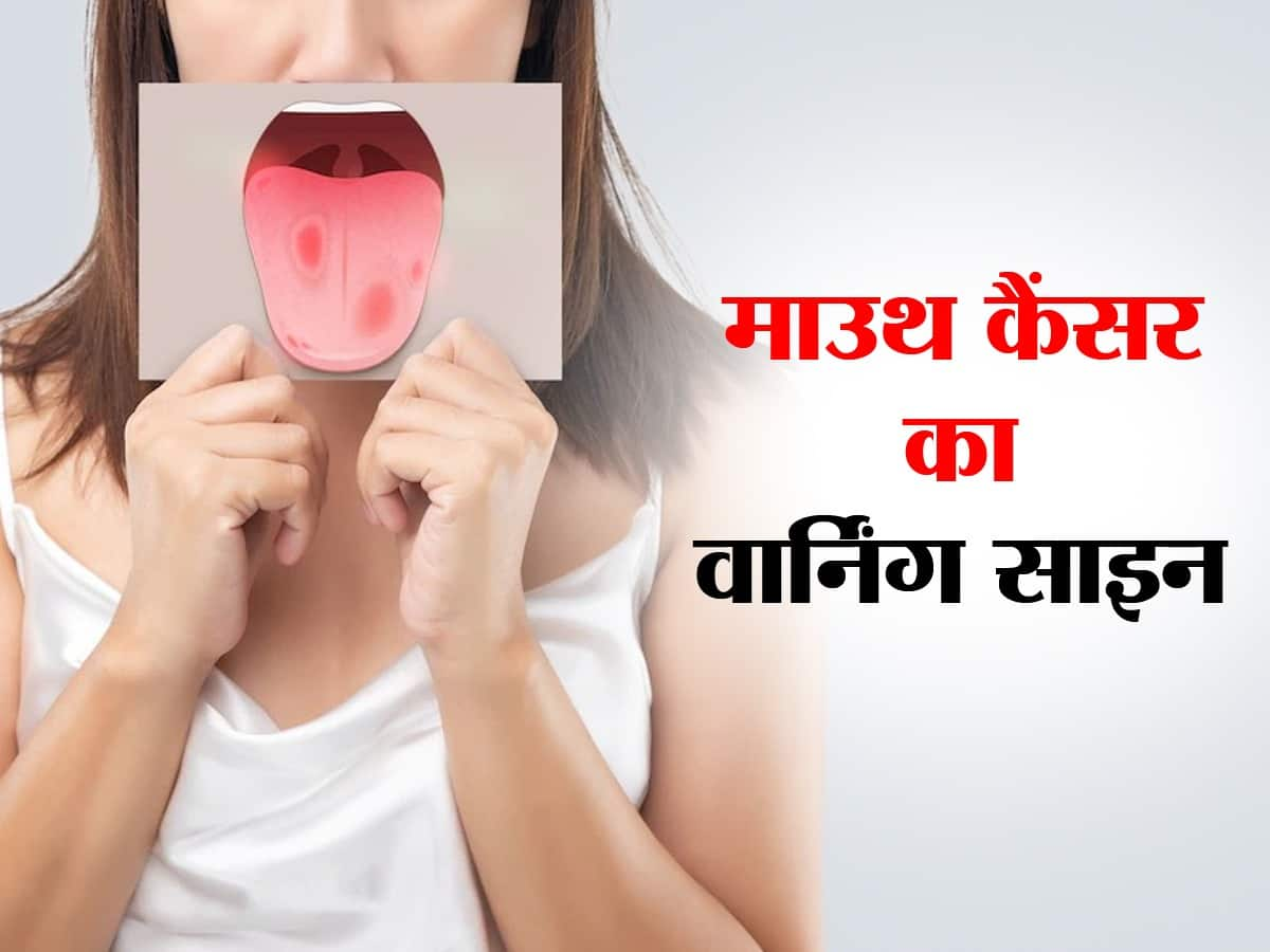 Mouth Cancer Symptoms Oral Cancer Signs ओरल कैंसर की ओर इशारा कर