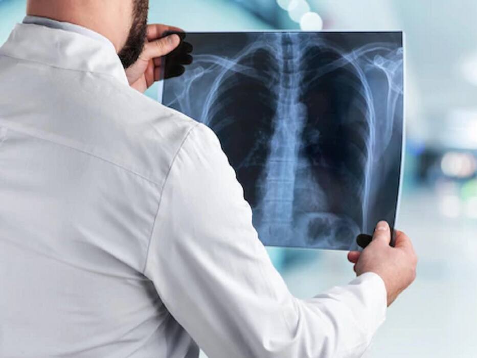 Black Lung Disease: All You Want To Know About This Job-Related Illness