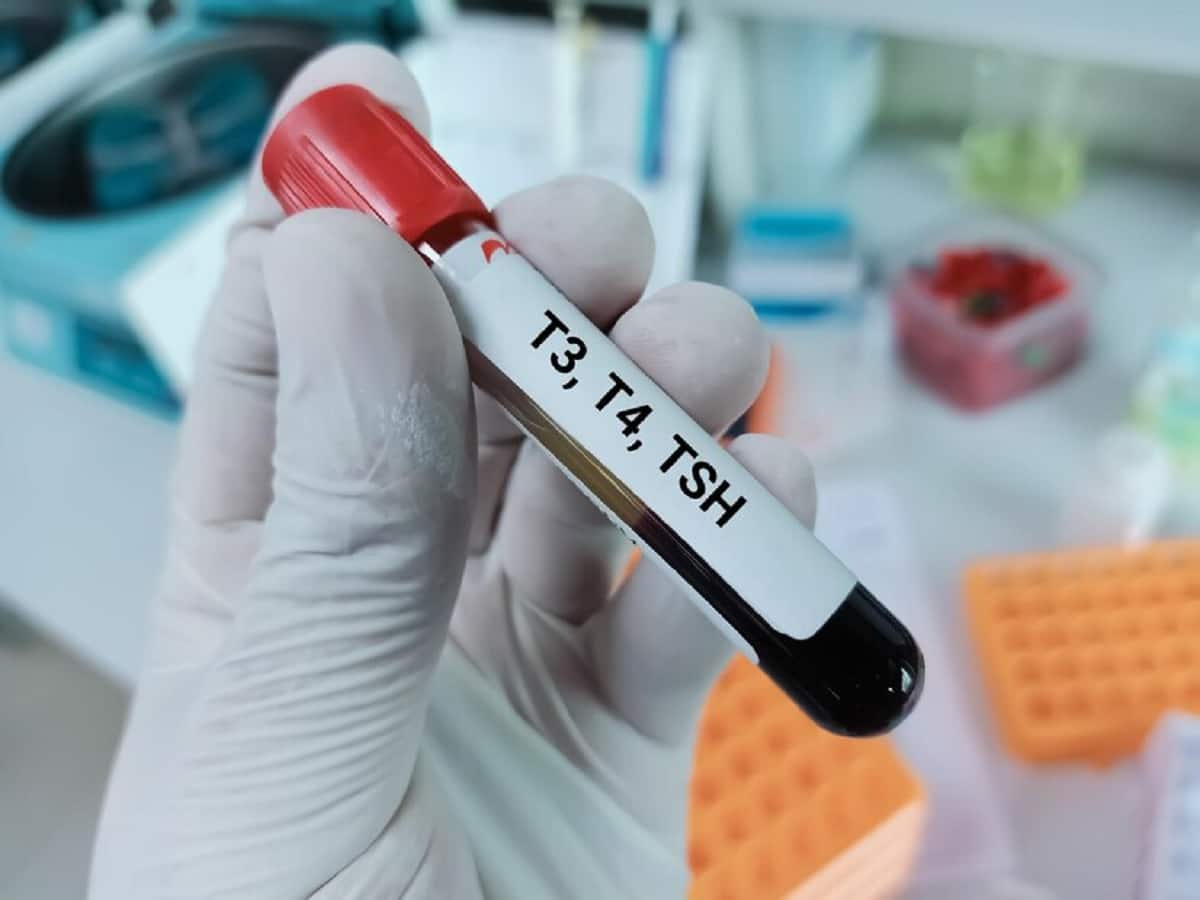 How thyroid disorders affect fertility in men and women? How thyroid disorders affect fertility in men and women?